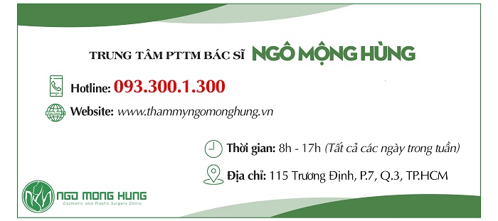 Nên bấm mí hay cắt mí