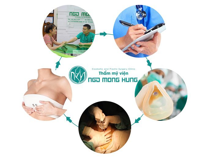 Giá phẫu thuật nâng ngực nội soi Giá phẫu thuật nâng ngực nội soi