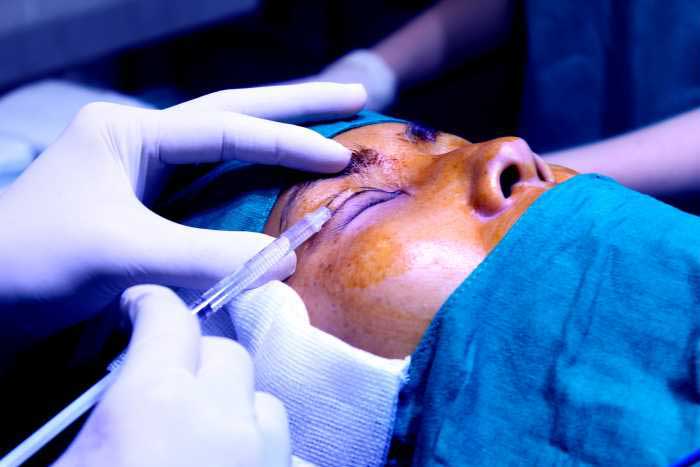 Cách phẫu thuật cắt bọng mỡ mắt