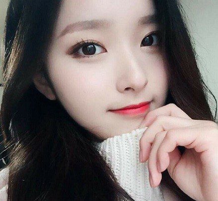 Cắt chỉ sau cắt mí mắt Cắt chỉ sau cắt mí mắt