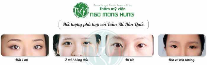 Bấm mí có đau không