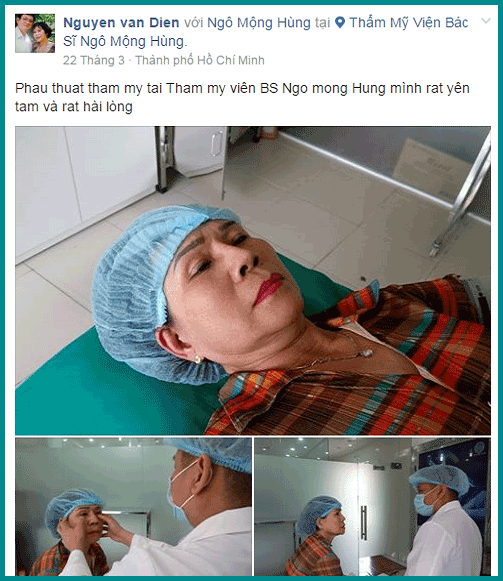 Phẫu thuật mắt cười Hàn Quốc