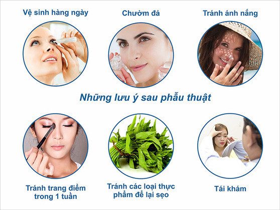 Nâng chân mày webtretho| Giải pháp làm đẹp hiệu quả Nang-chan-may-webtretho-2