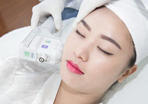 Căng da mặt bằng laser Căng da mặt bằng laser