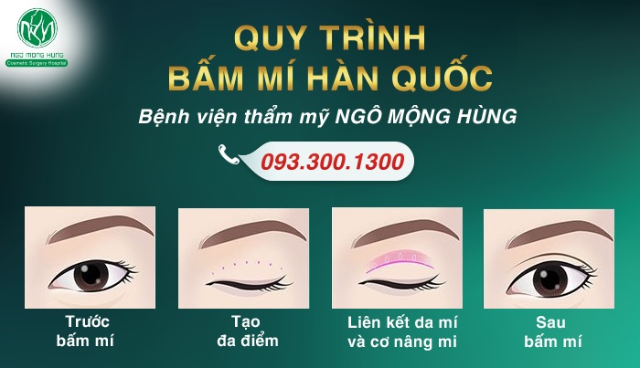 Nên bấm mí Hàn Quốc ở đâu cho an toàn? Bam-mi-han-quoc