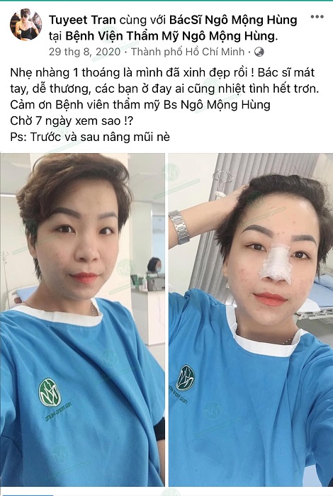 Bác Sĩ nào nâng mũi đẹp ở Hà Nội