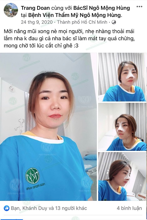 Địa chỉ phẫu thuật nâng mũi đẹp ở Hà Nội