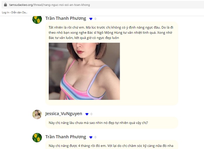 Thẩm mỹ nâng ngực ở Sài Gòn