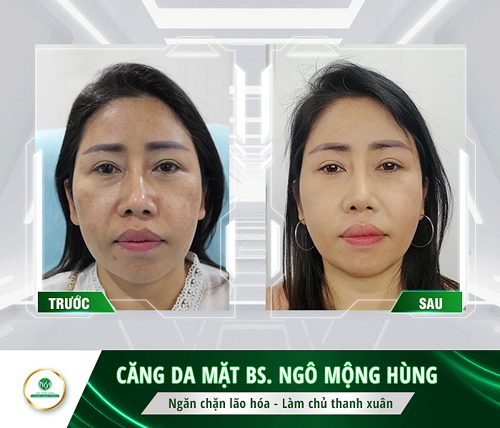 cách làm trắng da mặt nhanh và hiệu quả