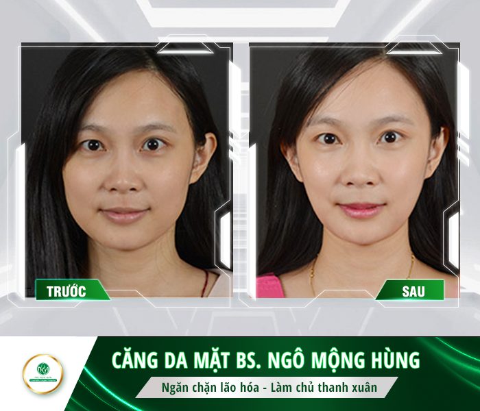 dùng kem làm trắng da mặt có tốt không