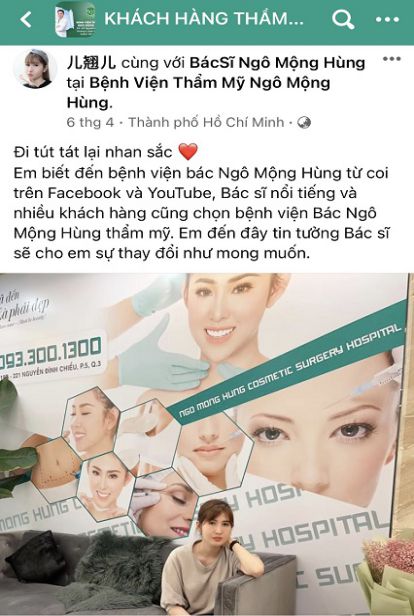 Hút mỡ nọng cằm sau bao lâu thì đẹp