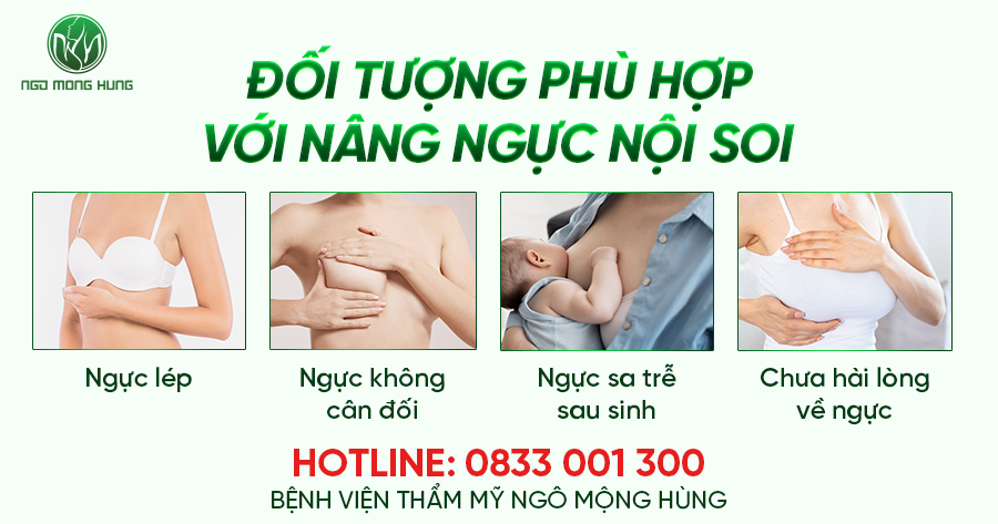 Nâng ngực