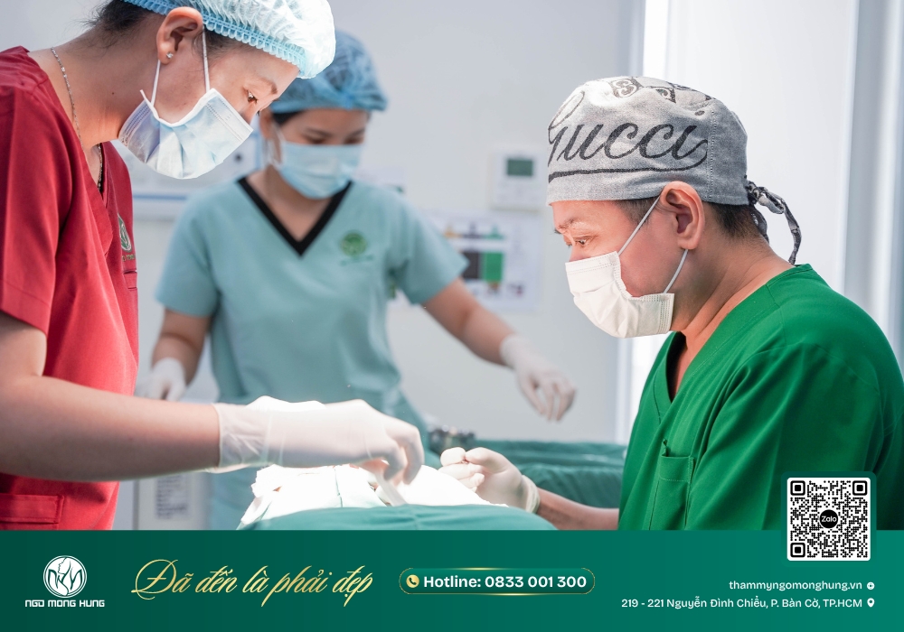 cắt khoé mắt ngoài