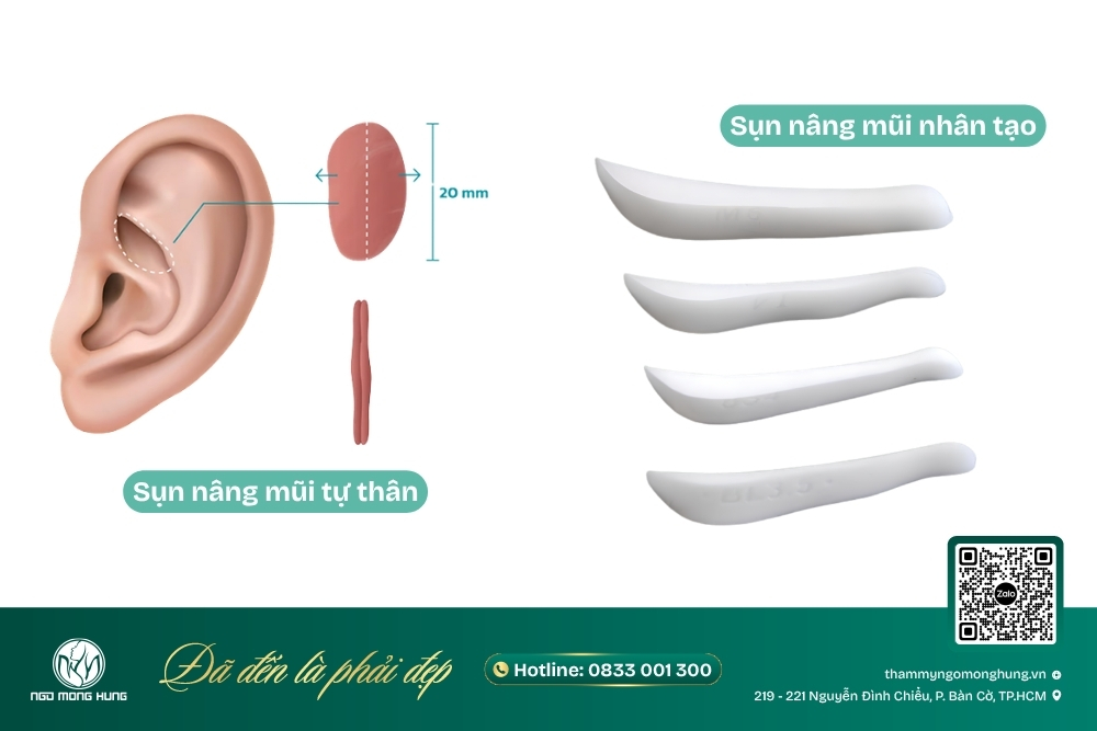 nâng sụn mũi