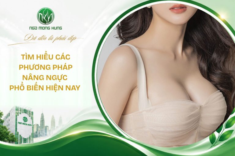 các phương pháp nâng ngực
