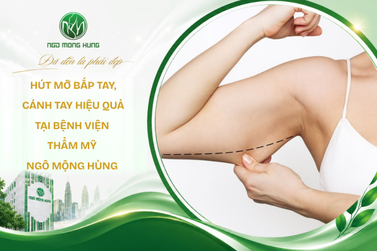 hút mỡ bắp tay