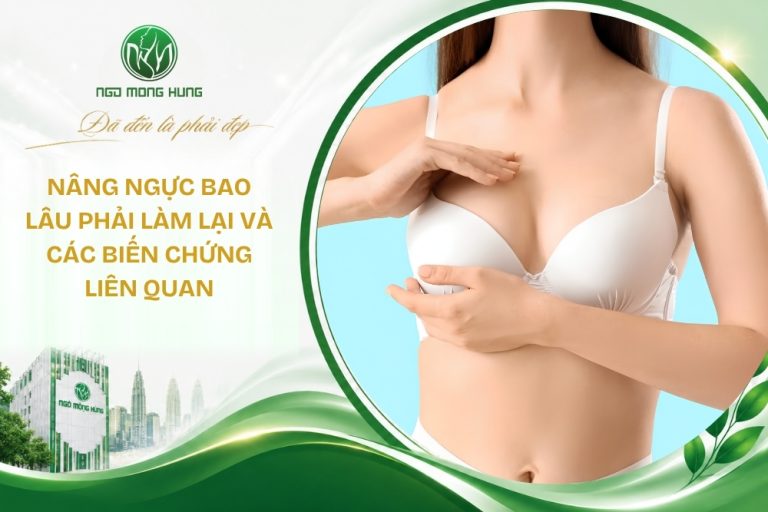 nâng ngực bao lâu phải làm lại