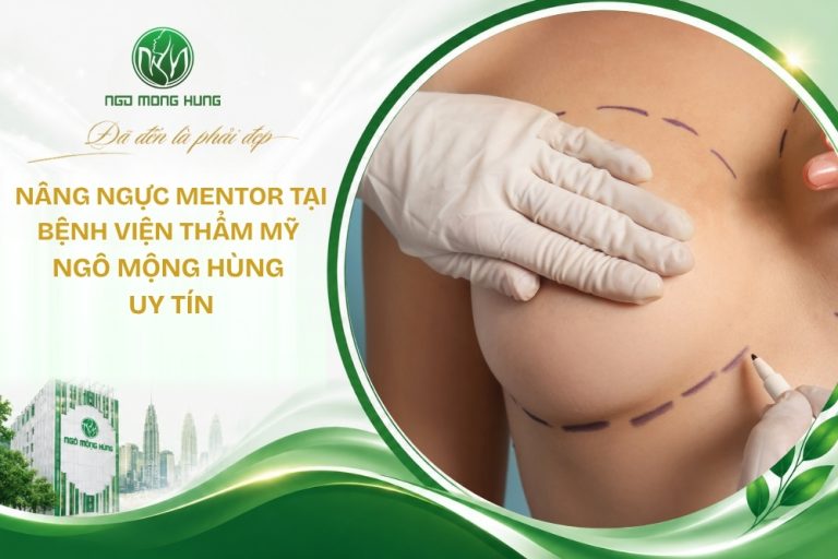 nâng ngực mentor