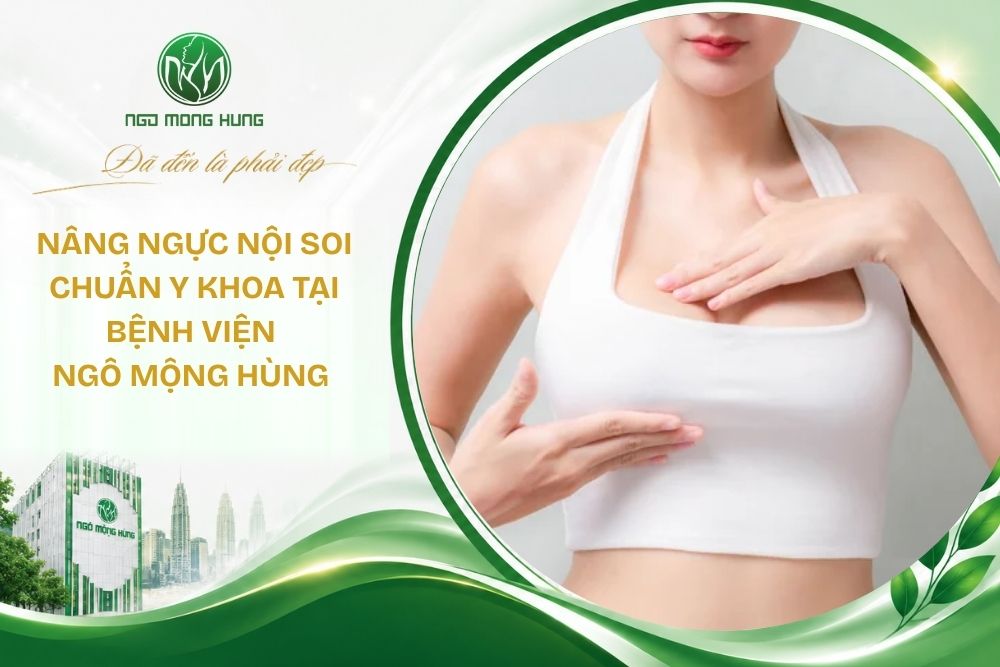 Nâng ngực nội soi chuẩn y khoa tại Bệnh viện Ngô Mộng Hùng