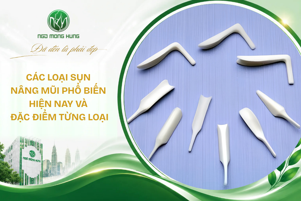 Các loại sụn nâng mũi phổ biến hiện nay và đặc điểm từng loại