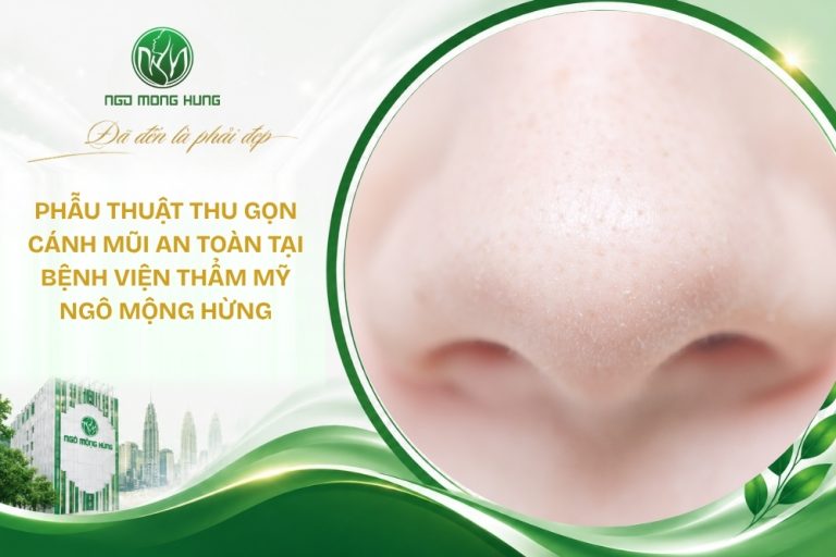 phẫu thuật cánh mũi