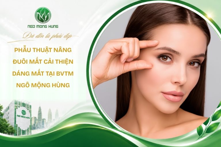 phẫu thuật nâng đuôi mắt