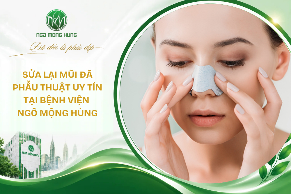 Sửa lại mũi đã phẫu thuật uy tín tại Bệnh viện Ngô Mộng Hùng