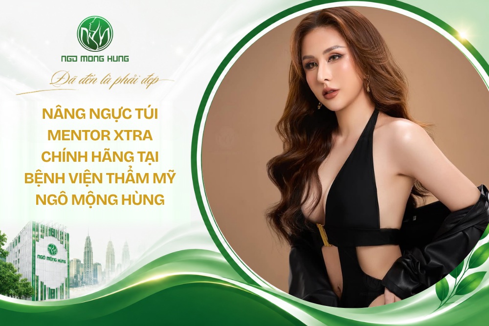 Nâng ngực túi Mentor Xtra chính hãng tại Bệnh viện thẩm mỹ Ngô Mộng Hùng