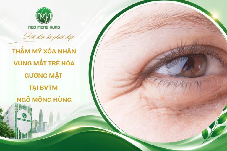 thẩm mỹ xóa nhăn vùng mắt