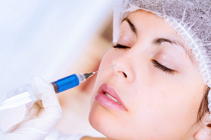 Nâng mũi bằng Filler Webtretho Nâng mũi bằng Filler Webtretho