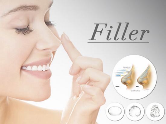 Nâng mũi không phẫu thuật ở đâu đẹp Nâng mũi không phẫu thuật ở đâu đẹp