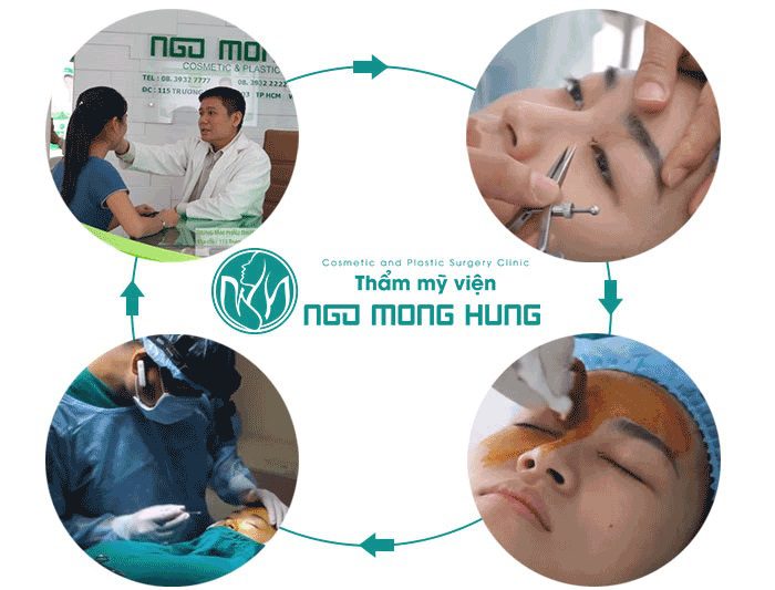 Đàn ông mắt xếch thì sao